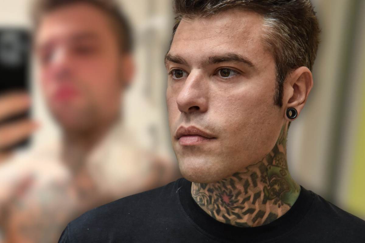 fedez problemi di salute